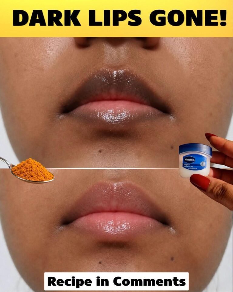 Vaseline Uses and Benefits for Skin, Lips and Hair