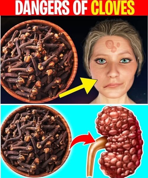 Avoid Cloves If You Have These Health Issues