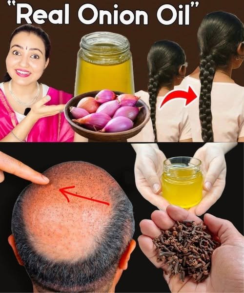 Cloves and Onion Peels: The Natural Hair Secret Hiding in Your Kitchen