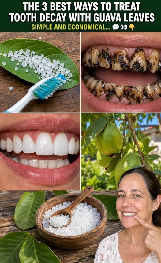 The 3 Best Ways to Treat Tooth Decay with Guava Leaves — Simple and Economical
