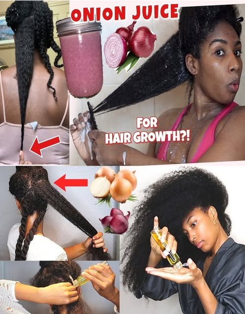 Grow Hair Fast in 4 Weeks with Homemade Onion Oil