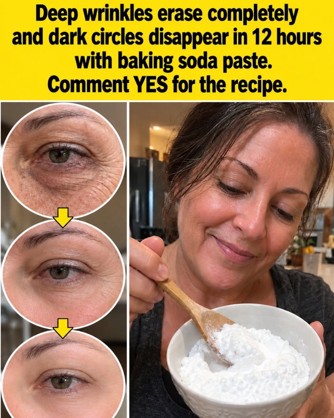 Baking Soda Under-Eye Paste: The Fastest Way to Calm Tired-Looking Skin Without Harsh Steps