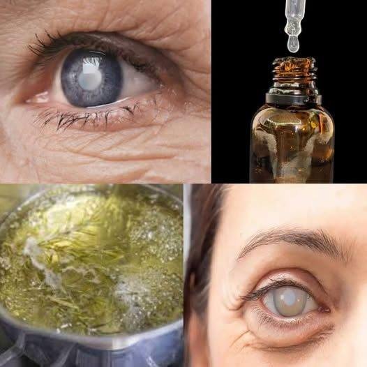 It KILLS Cataracts, Restores Vision and Relieves Eye Inflammation – Rosemary